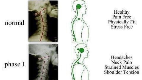 BACK HEALTH - a special workshop for all.