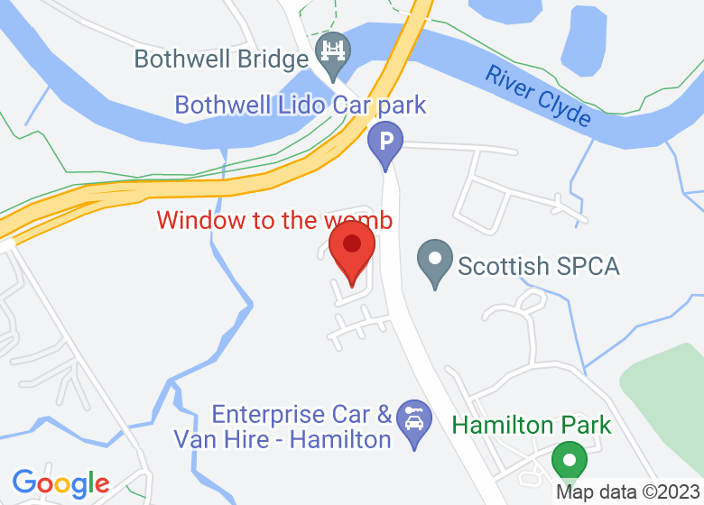 Map showing location of Window to the womb